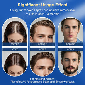 Kweqdsd applied to beard patch illustrating targeted regrowth support