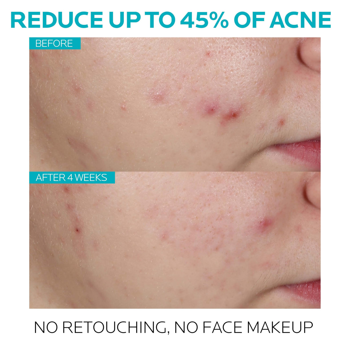 La Roche-Posay serum dropper dispensing two drops demonstrating precise, non-greasy application
