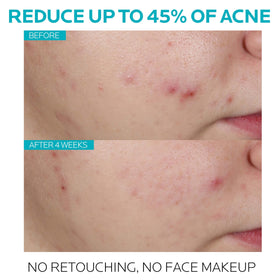 La Roche-Posay serum dropper dispensing two drops demonstrating precise, non-greasy application