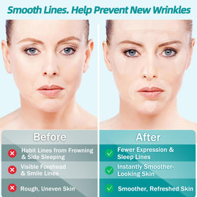 LadPemo patch applied to forehead demonstrating secure placement and smoothing benefit