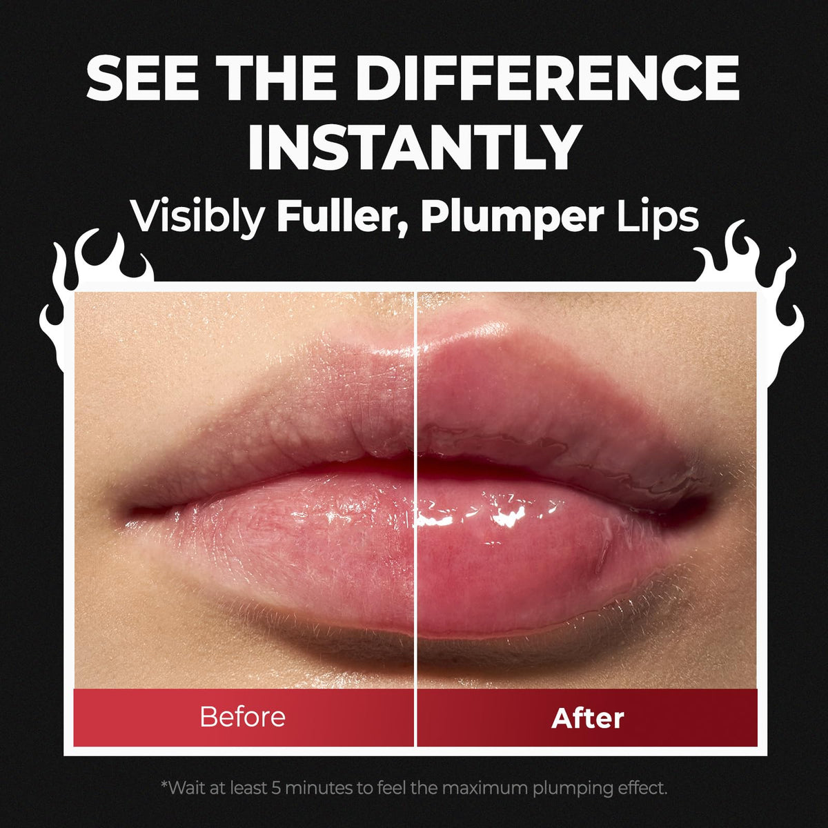 Laka before and after lips comparison showing fuller-looking pout