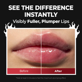 Laka before and after lips comparison showing fuller-looking pout