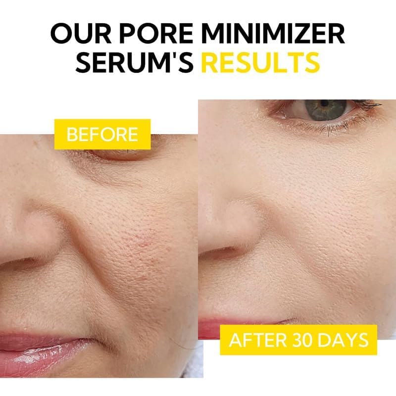 LANBENA mask being applied to nose, visualizes easy targeted coverage