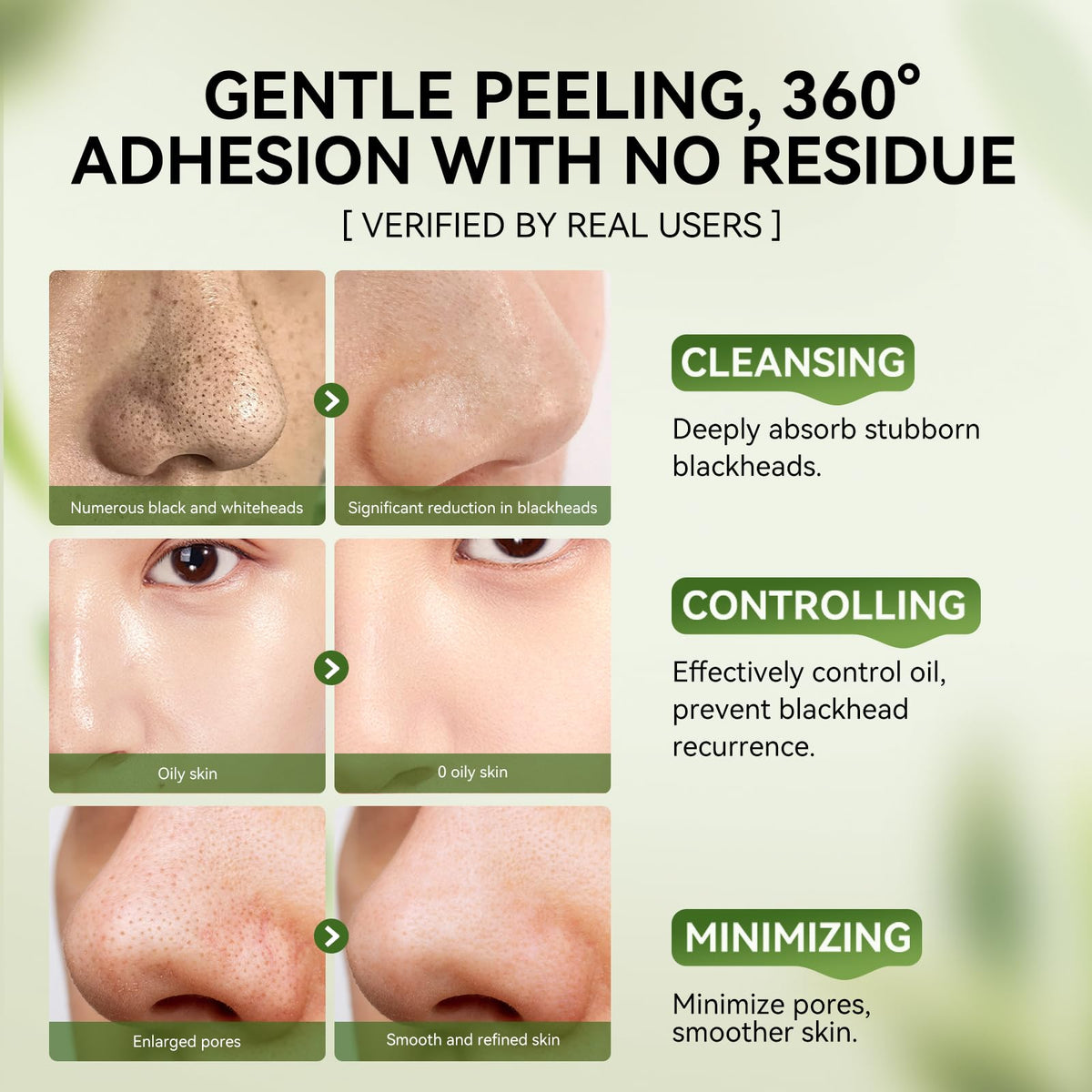 LANBENA nose strip applied on nose demonstrating targeted extraction