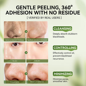 LANBENA nose strip applied on nose demonstrating targeted extraction