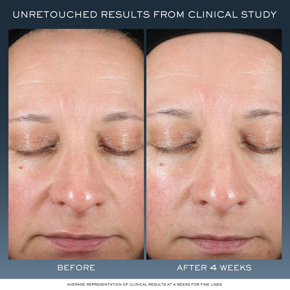 Lancôme cream texture close-up highlighting rich, melting formula and hydration benefit