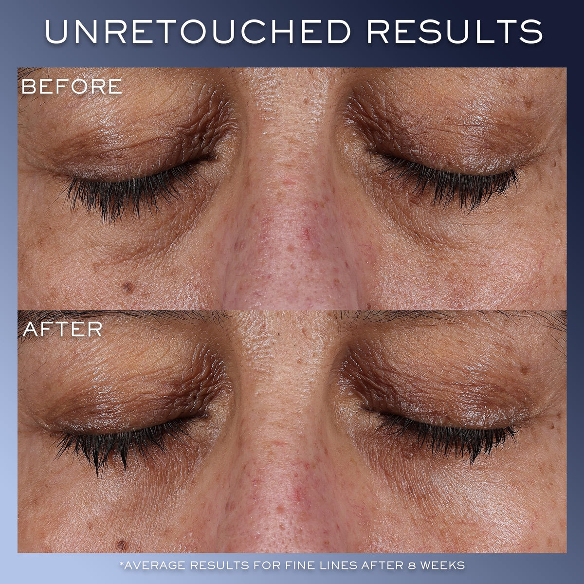 Lancôme Génifique hyaluronic acid ingredient close-up highlighting moisture boost