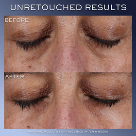 Lancôme Génifique hyaluronic acid ingredient close-up highlighting moisture boost