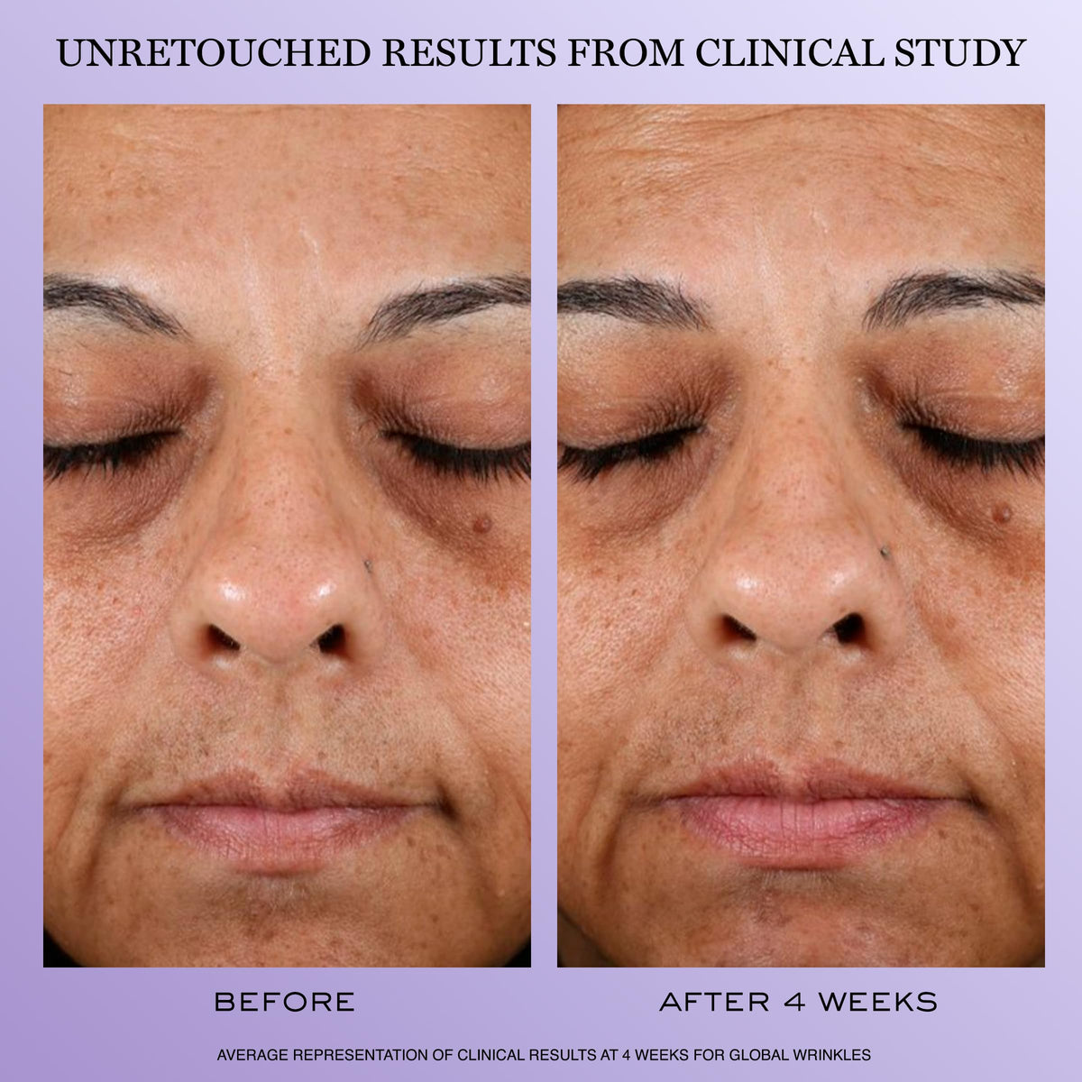 Lancôme ingredient concept showing peptides and hyaluronic acid benefits