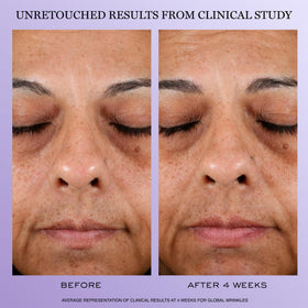 Lancôme ingredient concept showing peptides and hyaluronic acid benefits