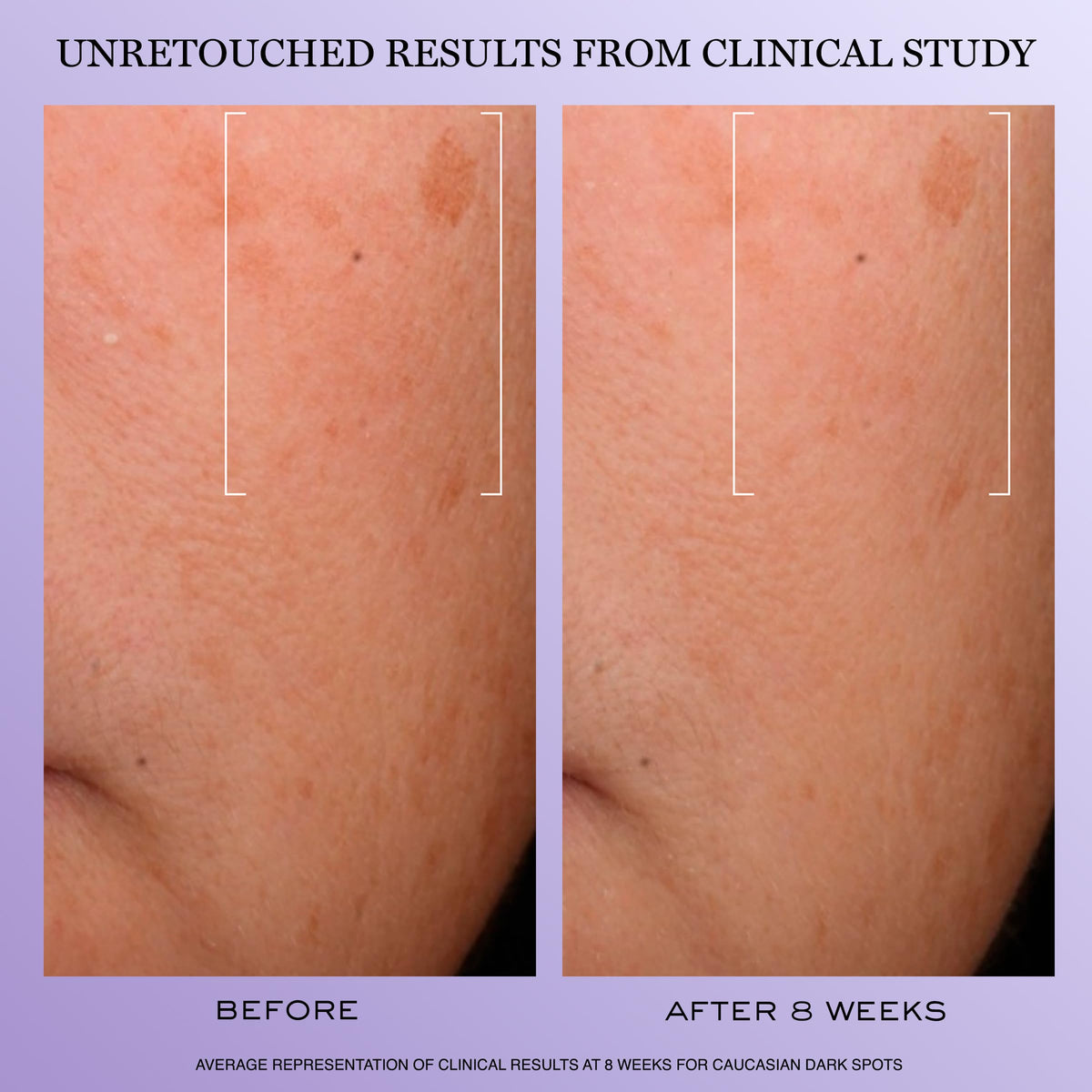 Lancôme ingredient visuals depicting hyaluronic acid and vitamin C for brightening benefits