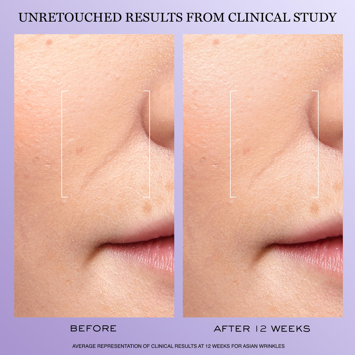 Lancôme serum drop on skin showing lightweight texture and quick absorption benefit