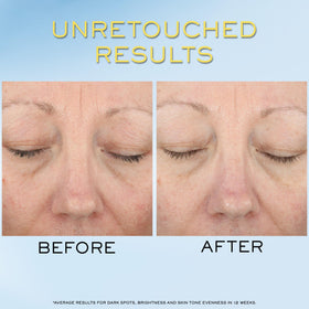 Lancôme ingredient label highlighting niacinamide vitamin Cg and hyaluronic acid