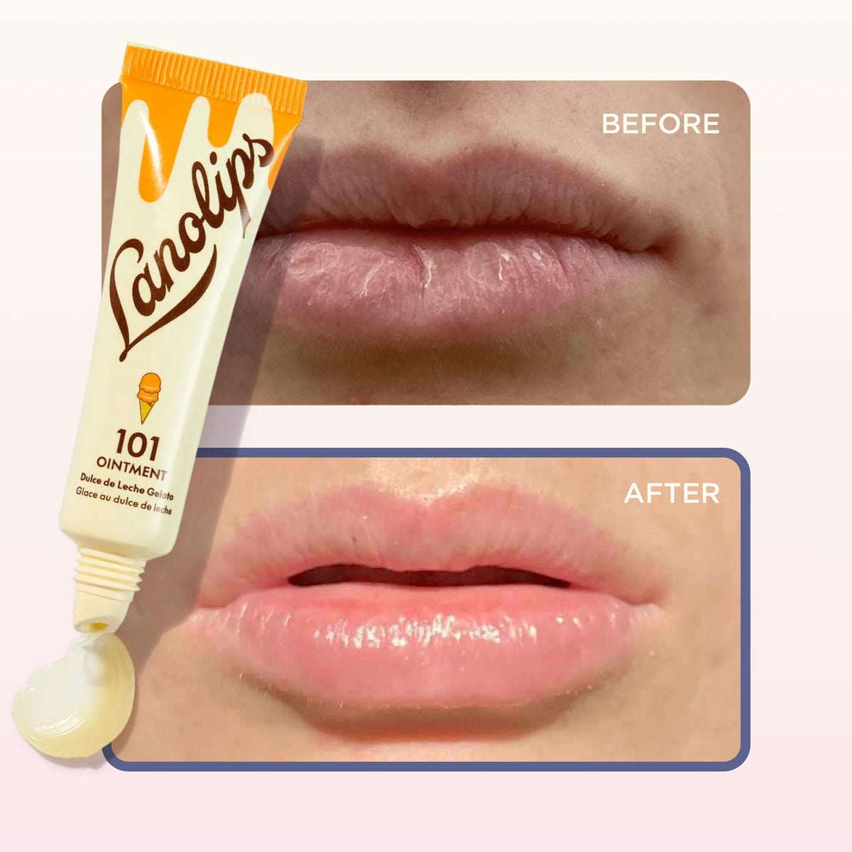 Lanolips used on elbow showing reduced roughness and improved comfort