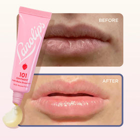 Lanolips used on elbow in lifestyle shot for rough patch care