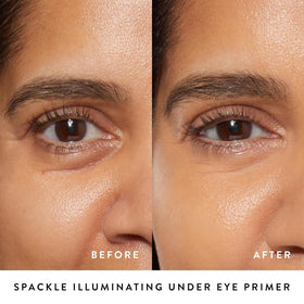 LAURA GELLER before and after under-eye comparison showing reduced look of darkness and smoother texture