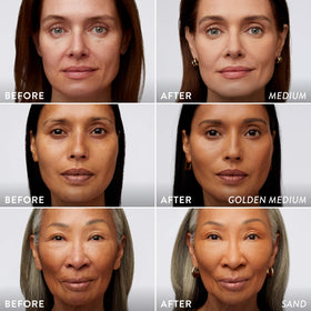 LAURA GELLER NEW YORK before and after coverage comparison showing visible correction benefit