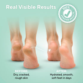 Lavinso label detail highlighting 40% urea and ingredients for informed purchase decisions