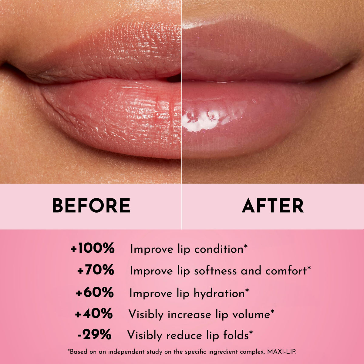 LAWLESS before and after lips showing smoother lines and visibly fuller appearance