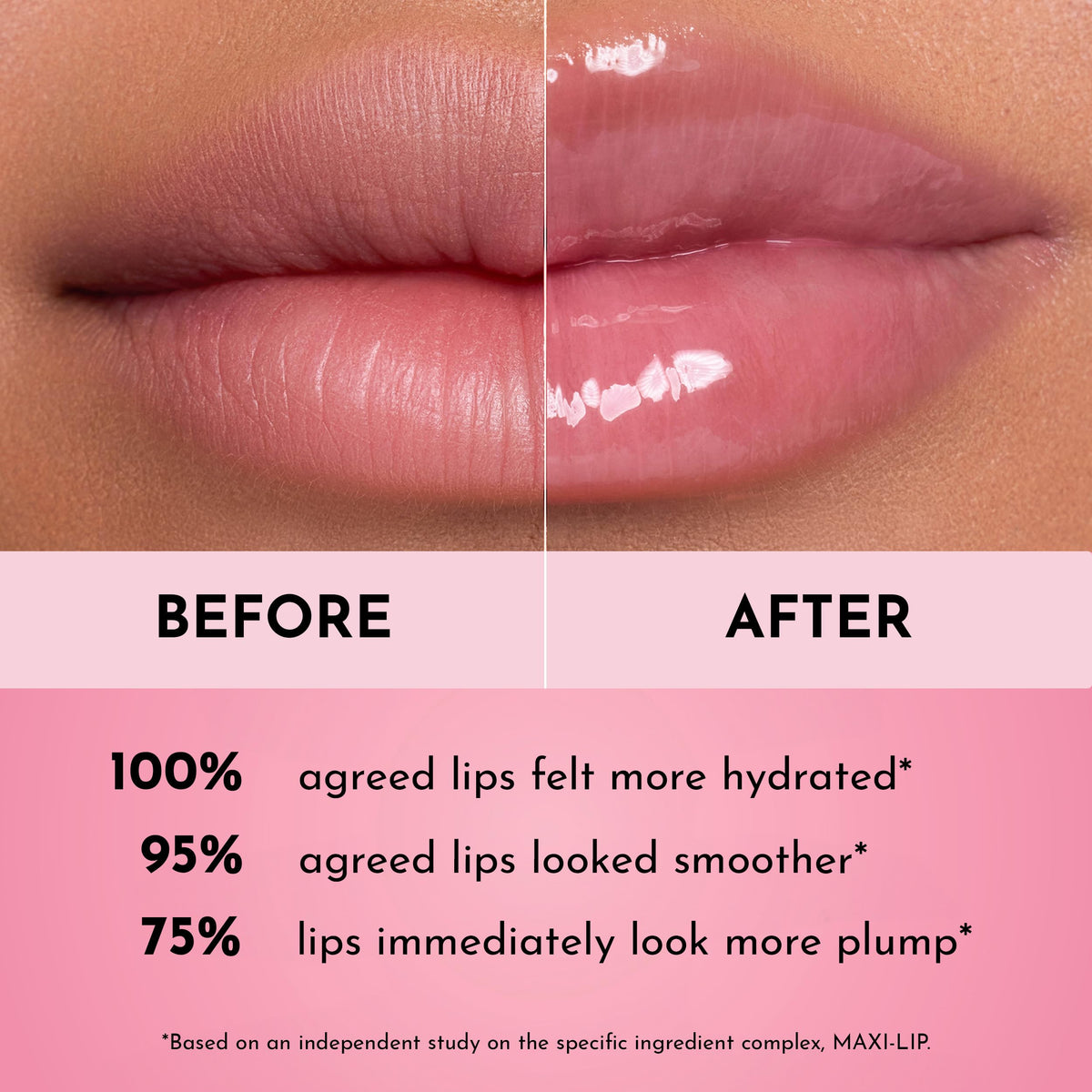 Lawless lip application on model showing visible plumping and smooth lines
