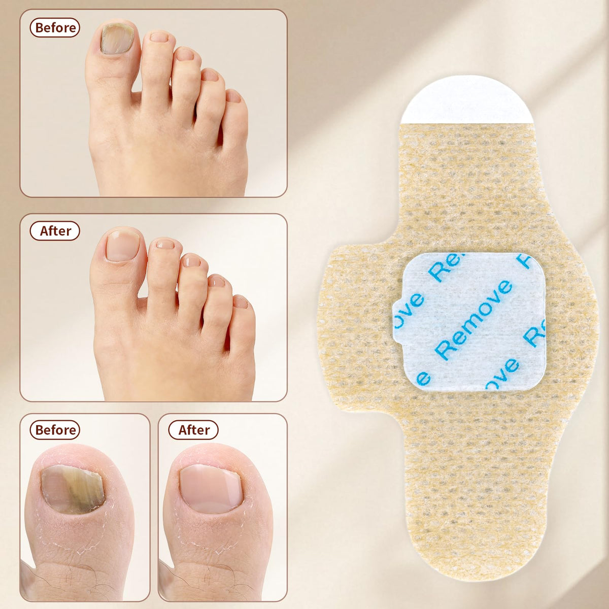 LAYOOYOO patch fabric close-up highlighting soft breathable texture for gentle nail care