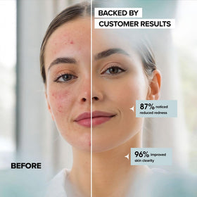 lebogner close-up of dual-texture surface for deeper cleansing without irritation