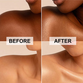 Lezero applied on neck and shoulders for subtle luminous definition