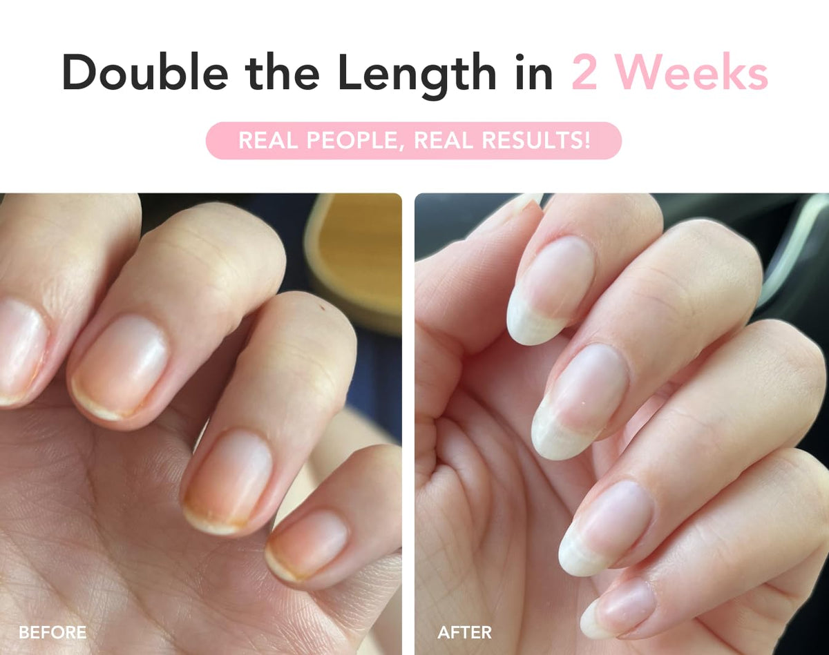 Liaison UltraGrow applied to a natural nail, illustrating strengthened, smoother surface