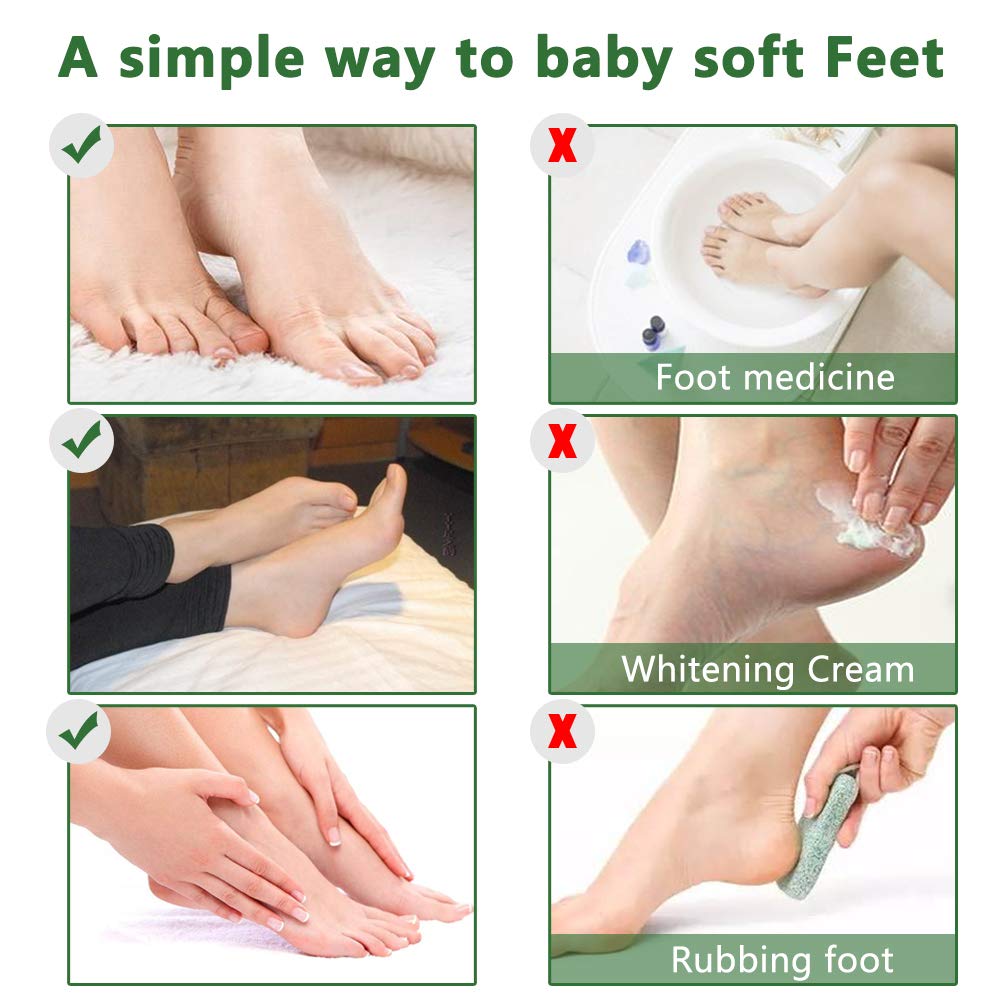 Before and after feet comparison with Liefiet showing reduced calluses and smoother skin