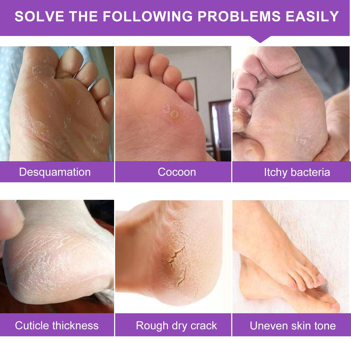 Liefiet application image of person wearing booties demonstrating easy at-home use