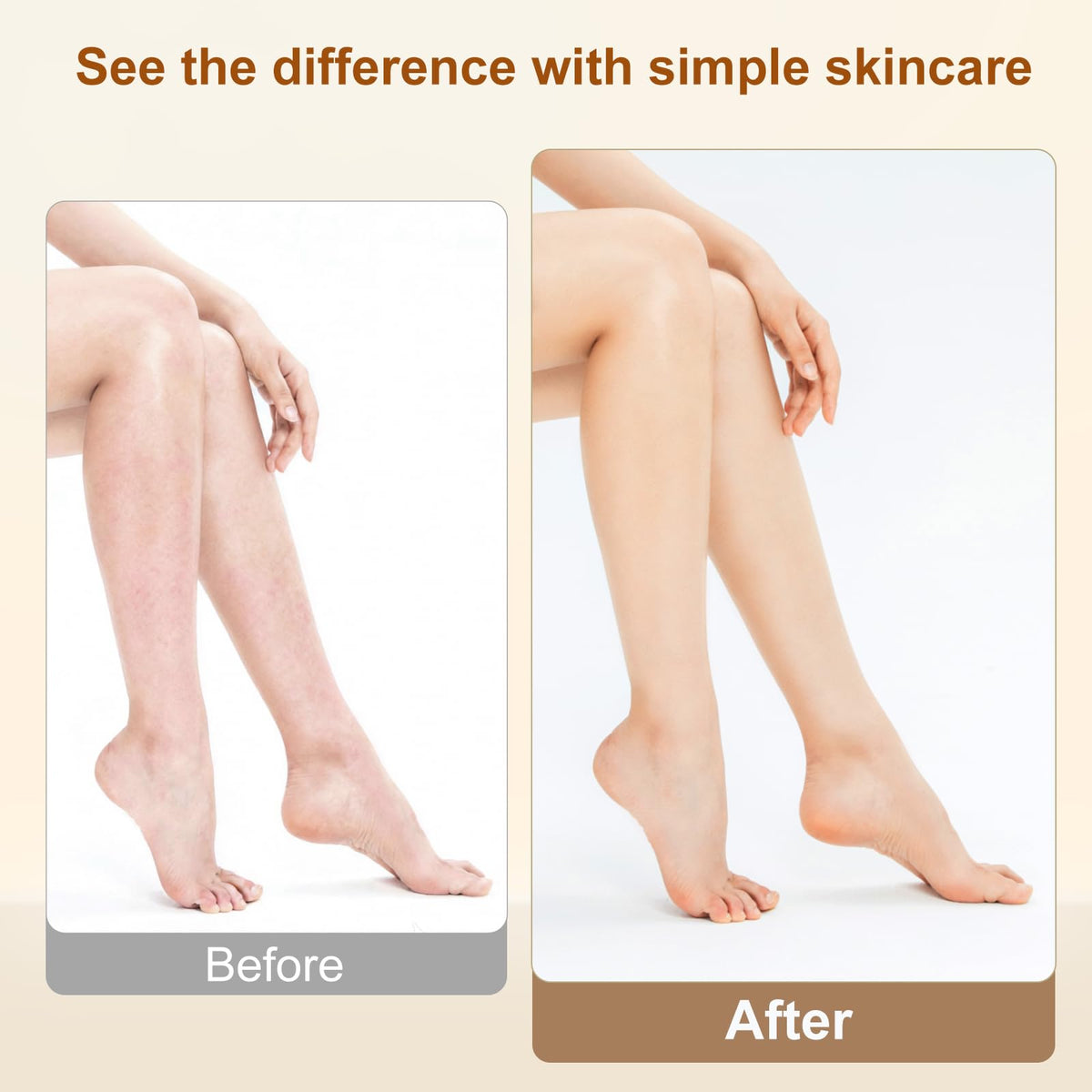 Lilei Beauty elbow before and after showing visible hydration improvement benefit