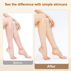 Lilei Beauty elbow before and after showing visible hydration improvement benefit