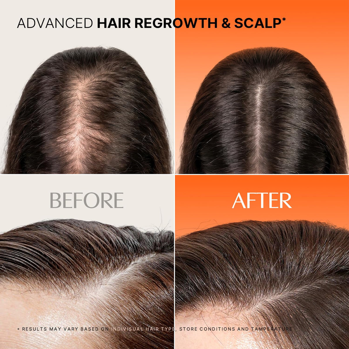 lilyeve ampoule drop applied to scalp illustrating targeted care and quick absorption