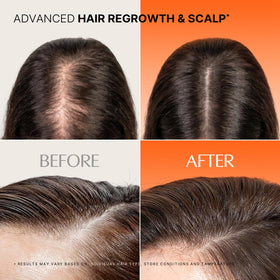 lilyeve ampoule drop applied to scalp illustrating targeted care and quick absorption