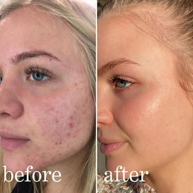 lissy skincare serum drop on hand demonstrating lightweight absorbency