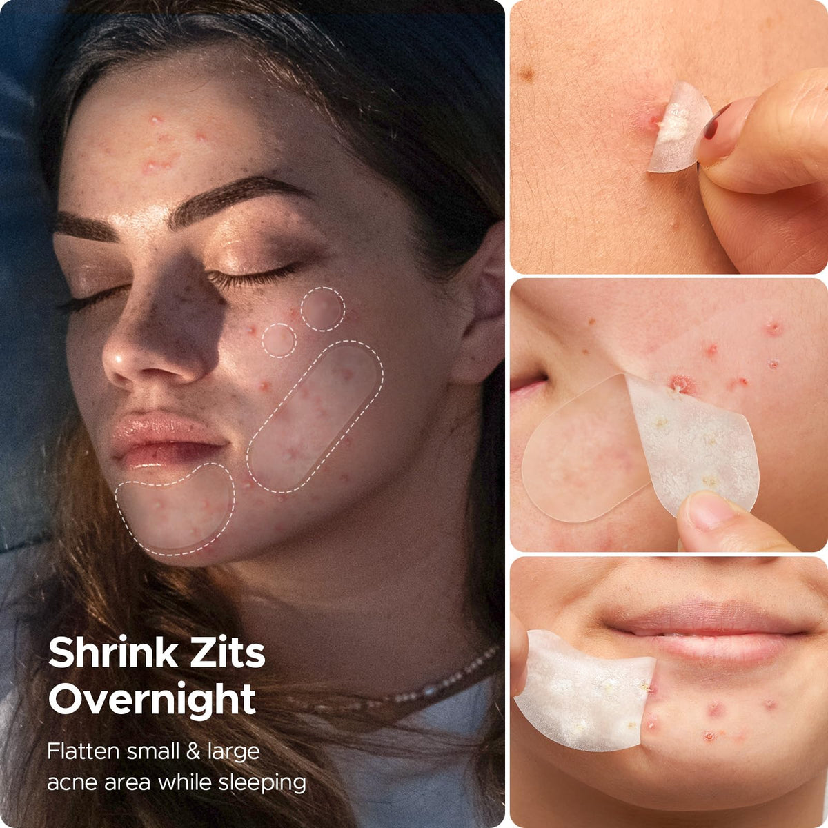 LitBear spread displaying five sizes included for matching different blemishes quickly