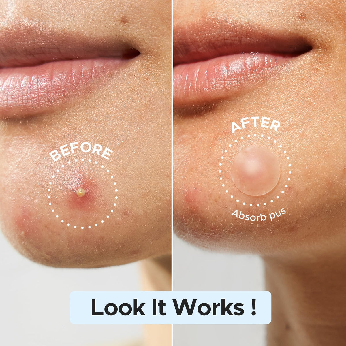 LitBear patch applied on cheek providing discreet protection