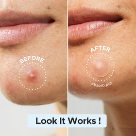 LitBear patch applied on cheek providing discreet protection