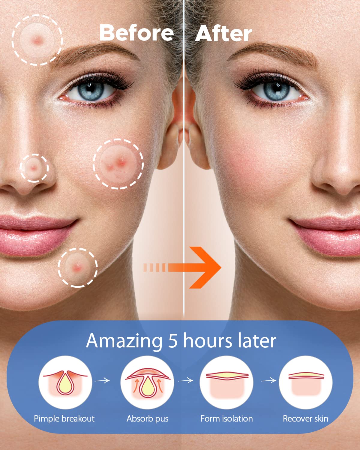 LitBear hydrocolloid texture detail highlighting absorbent surface performance
