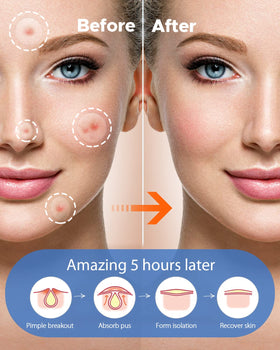 LitBear hydrocolloid texture detail highlighting absorbent surface performance