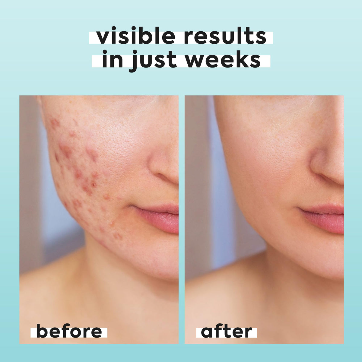 LivaClean close-up label displaying 0.02% HOCl and pH 4.5 benefits