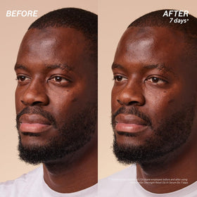 L'OCCITANE Immortelle before and after visual suggesting improved skin radiance