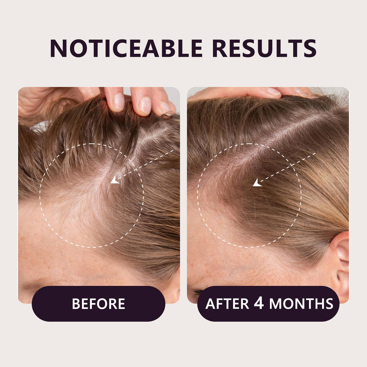 LONGCCI label close-up highlighting active 5% minoxidil and biotin blend for clarity