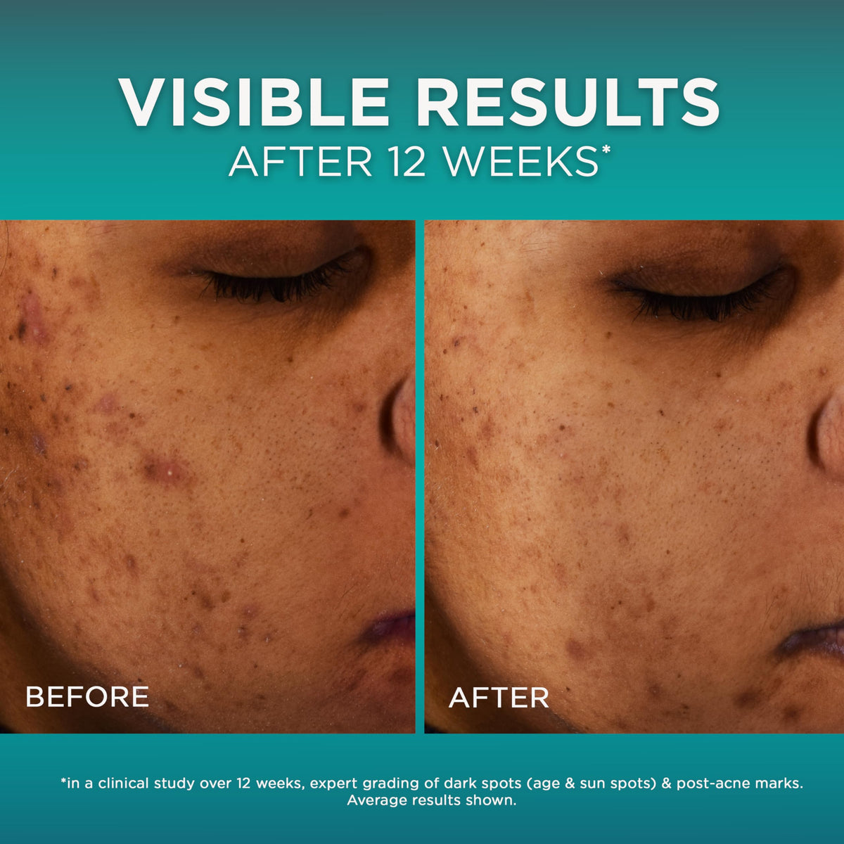 L'Oreal Paris serum with moisturizer sample, shows complementary routine convenience