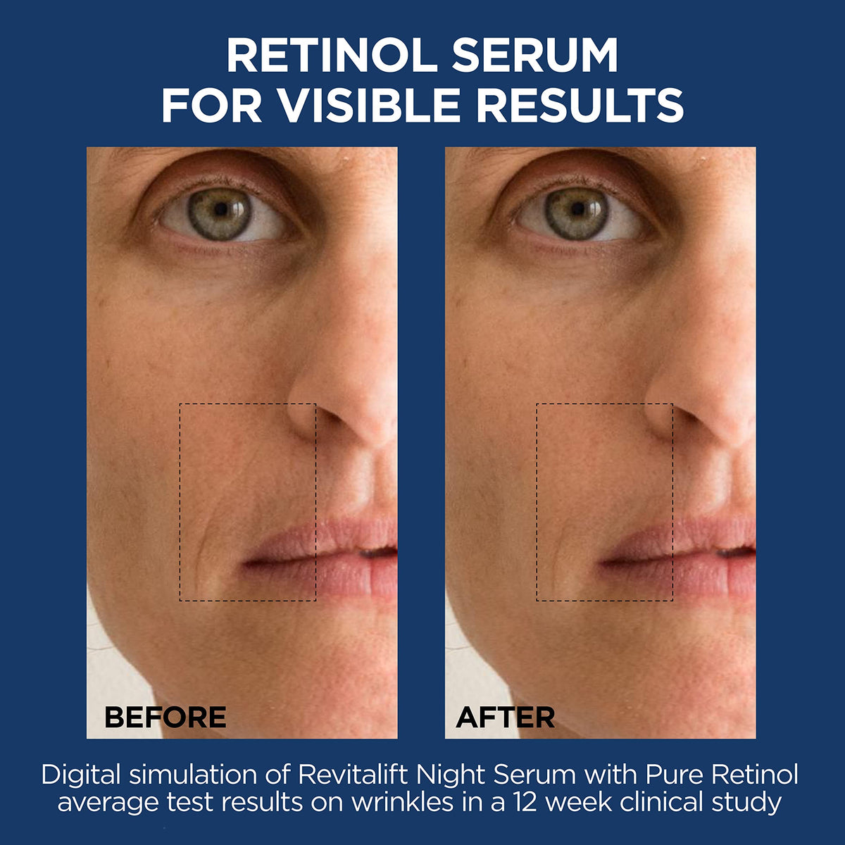 L'Oreal Paris retinol serum applied on hand demonstrating smooth absorbency