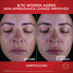 L'Oreal Paris applied to model neck and jawline improving firmness