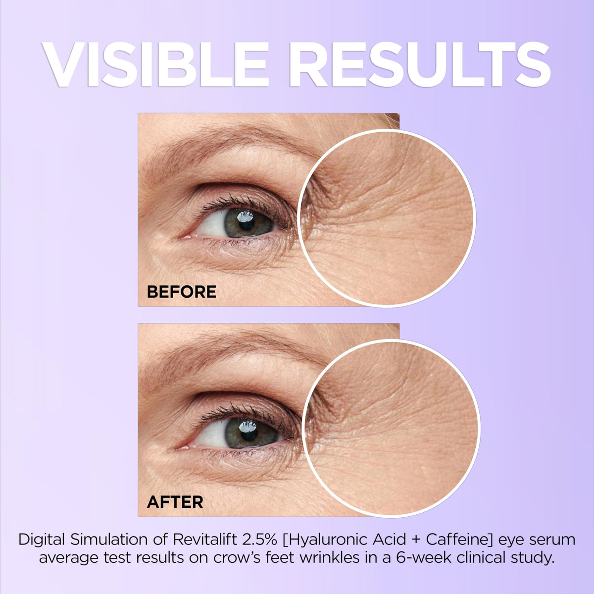 L'Oreal Paris tube label detail highlighting hyaluronic acid and caffeine