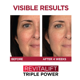 L'Oreal Paris Revitalift kit flatlay highlighting serum and Triple Power moisturizer