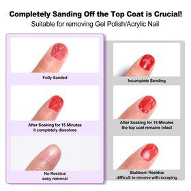 LOUINSTIC gel saturated on cotton pad for controlled application