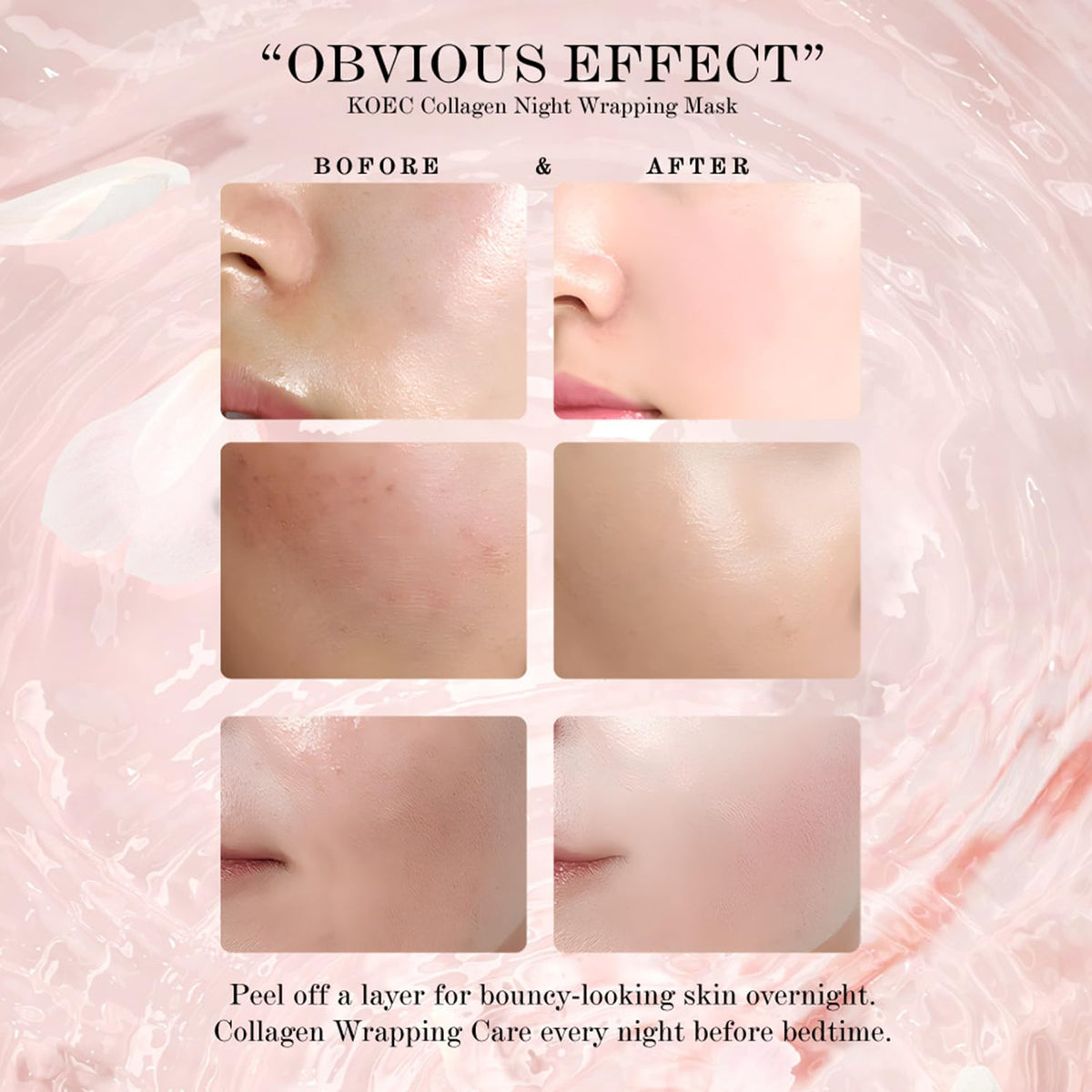 LOYOTICE morning peel result revealing firmer-looking skin and refreshed complexion